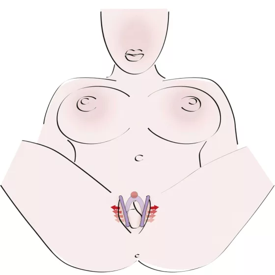 You2Toys - Intimate Spreader hüvely széthúzó